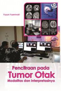 Pencitraaan pada Tumor Otak Modalitas dan Interpretasinya
